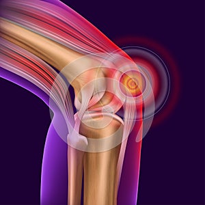 Knee pain. Trauma to the leg, patella, knee joint. photo