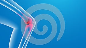 Knee painful. x-ray. Joint pains. 3d Vector illustration