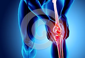 Knee painful - skeleton x-ray.