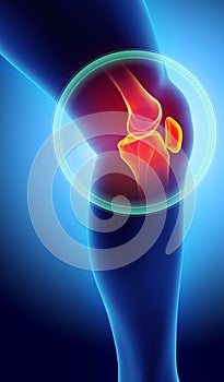 Knee painful - skeleton x-ray.