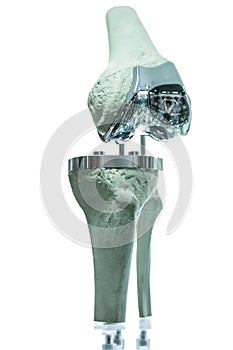 Knee prosthesis