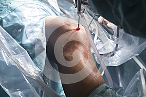 Knee surgery hospital operation