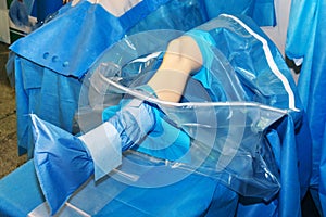 Knee Surgery. Plastic bag for collecting postoperative waste photo