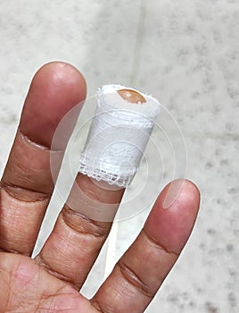 The knife cut off left ring finger, laceration wound , accident at home.