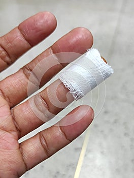 The knife cut off left ring finger, laceration wound , accident at home.