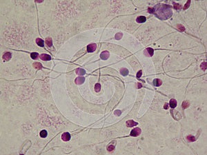 Human spermatozoid, frotis semen sample photo