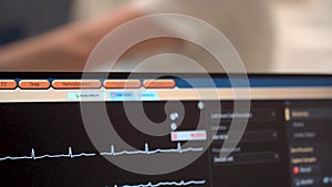 Kyiv, Ukraine - April 2023: Heart Institute. The patient monitor shows heart data