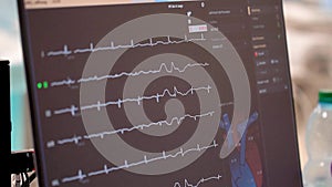 Kyiv, Ukraine - April 2023: Heart Institute. The patient monitor shows heart data