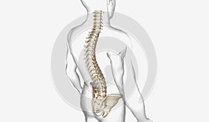 Kyphosis is any curvature in the upper back