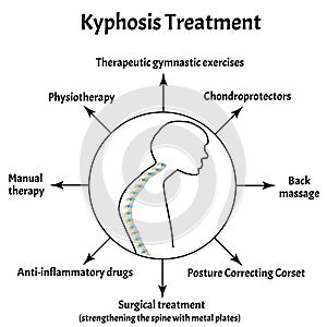 Kyphosis treatment. Spinal curvature, kyphosis, lordosis, scoliosis, arthrosis. Improper posture and stoop. Infographics