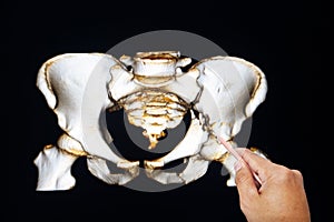 L doctor looking at the pelvis x-ray 3d film image or doctors analyzing pelvis x-ray fracture pubic bone