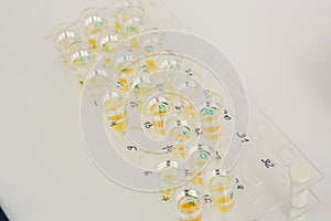 Lab tech loading samples into a chemistry analyzer