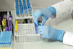 Lab technician assistant put test tubes in holder, clinic lab. Vaccine research