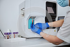 Lab technician carrying out a hematological test