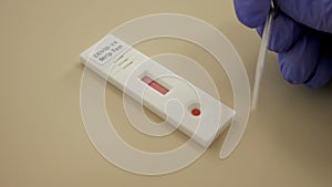 The lab technician does an express blood test using Strip Test. 10-Min Coronavirus diagnostic.
