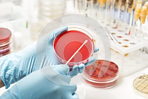 Lab technician hand planting a petri dish