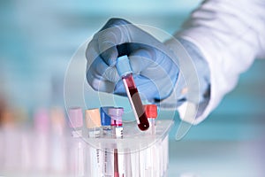 Lab technician holding blood tube sample for study