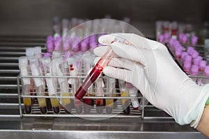 Lab technician holding blood tube test in blood bank background