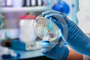 Lab technician holding a petri dish