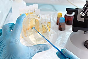 Lab technician holding a petri dish