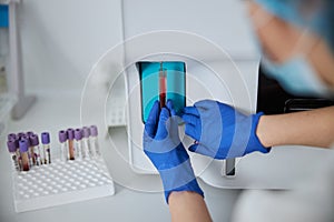 Lab worker using a hematology device for a biochemical analysis