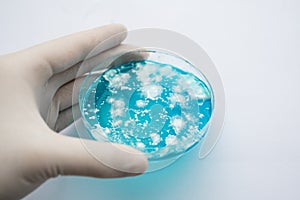 Laboratory accessories. Fungal mycelium petri dish. Mycology Growing in a Petri dishes