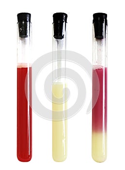 laboratory apparatus with colorful solution chemistry flask experiments tube