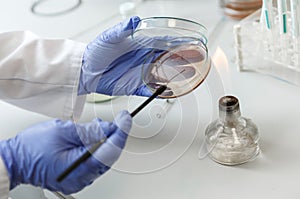 Laboratory assistant analyzes bacterium sample using medical equipment in a bacteriology clinic