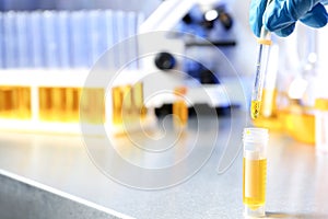 Laboratory assistant dripping urine sample from pipette into container on table, closeup with space for text.