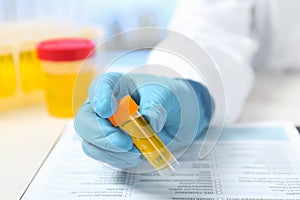 Laboratory assistant holding container with urine sample for analysis at table