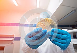 A laboratory assistant holds a petri dish containing gram-positive lactobacilli grown on agar as part of a scientific project