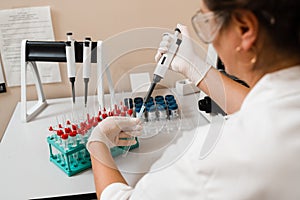 Laboratory assistant with microdoser in laboratory doing blood test analysis. Medical equipment in lab. Scientist with