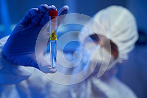 Laboratory assistant in protective gloves holds test tube with biomaterial