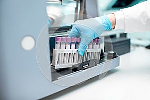 Putting test tubes into the analyzer machine