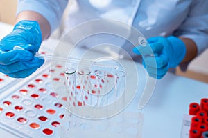 Laboratory determination of blood type. Blood test