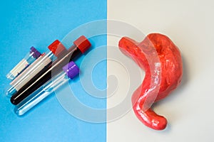 Laboratory diagnosis of metabolic function, diseases, biochemical violations, damage of stomach or gastric. Stomach or gastric and