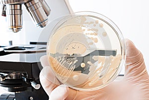 Laboratory doctor hand with gloves holding petri dish with bacteria