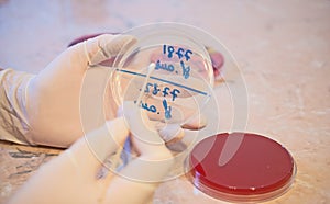 Laboratory doctor holding sterile swab and petri dish