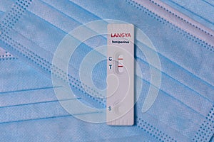Laboratory Express test Schnelltest with positive Langya henipavirus LayV on a medical masks.The virus is transmitted from photo