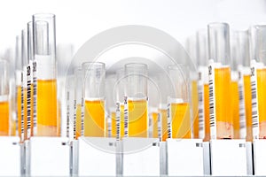 Laboratory glass test tubes filled with orange liquid for an experiment in a science research lab