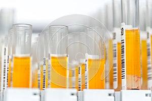 Laboratory glass test tubes filled with orange liquid for an experiment in a science research lab