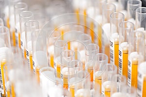 Laboratory glass test tubes filled with orange liquid for an experiment in a science research lab