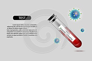 Laboratory and hospital testing sample of blood. result report of Positive of coronavirus Covid-19. Test nCoV-2019 Concept