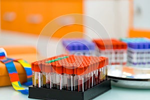 Laboratory microbiology scientific researchment. Medical stacks of analyzing blood tests.