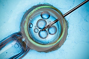 Microscopic research or IVF macro concept