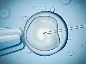 Laboratory microscopic research of IVF (in vitro fertilization). photo