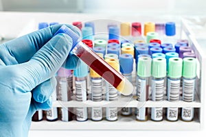 Laboratory technician holding a blood tube test