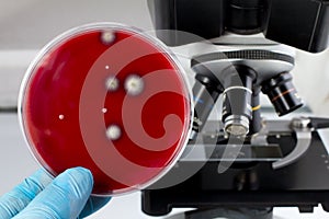 Laboratory technician holding petri dish with growth of fungi in