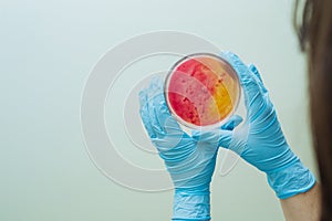 Laboratory technician testing for bacterial infection