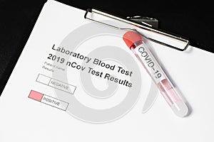 Testing kit for nCov, covid - 19, corona virus testing tube in laboratory photo